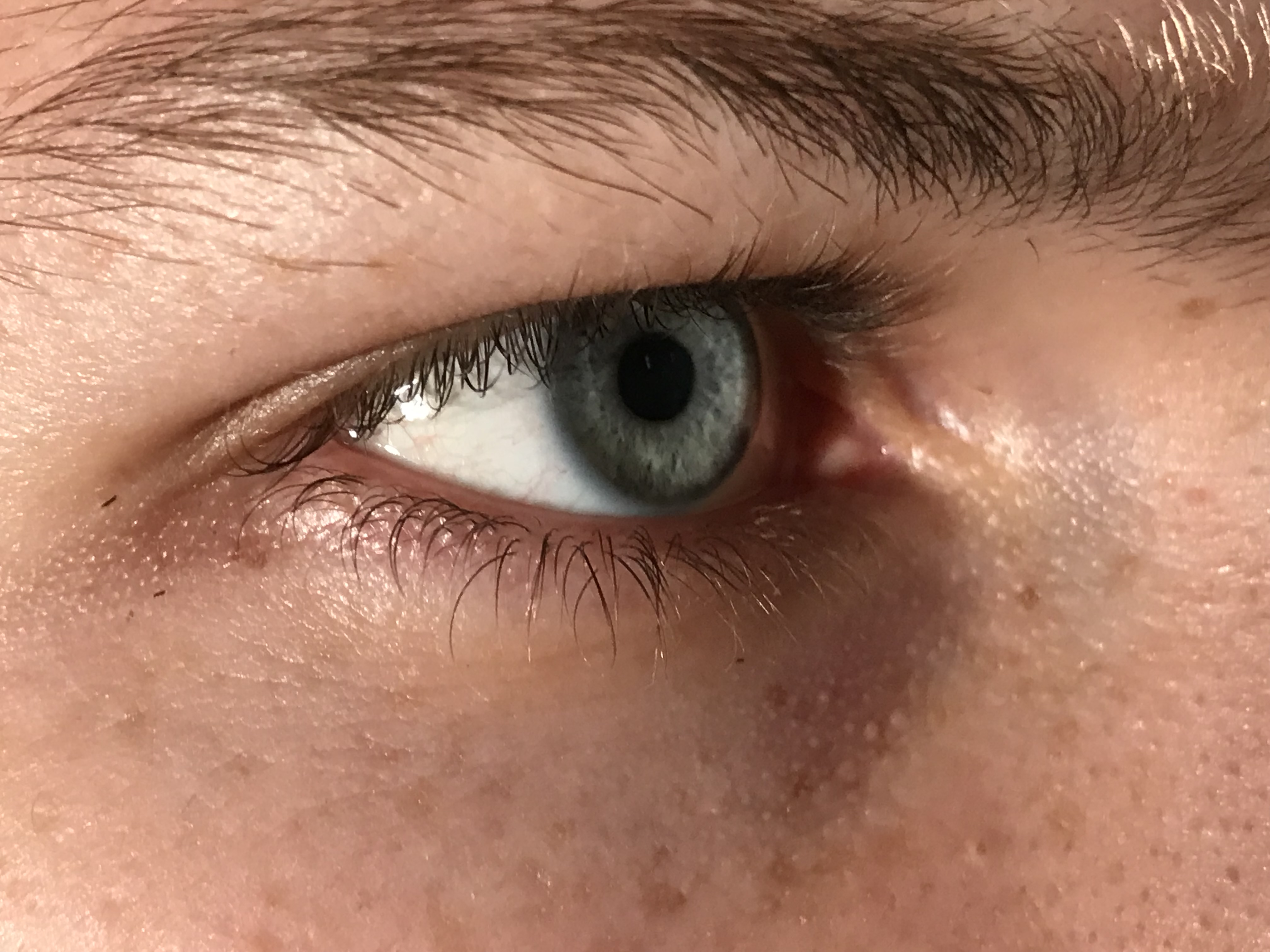 eye-detail-17